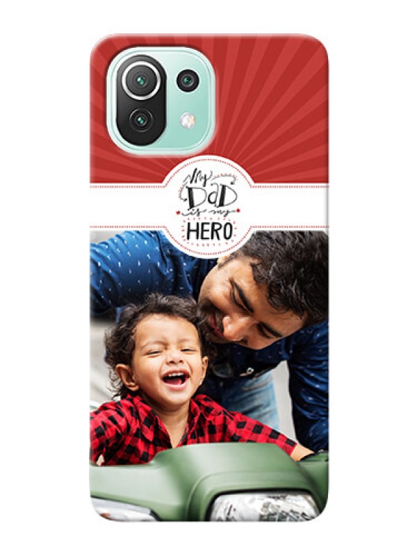 Custom Mi 11 Lite NE 5G custom mobile phone cases: My Dad Hero Design